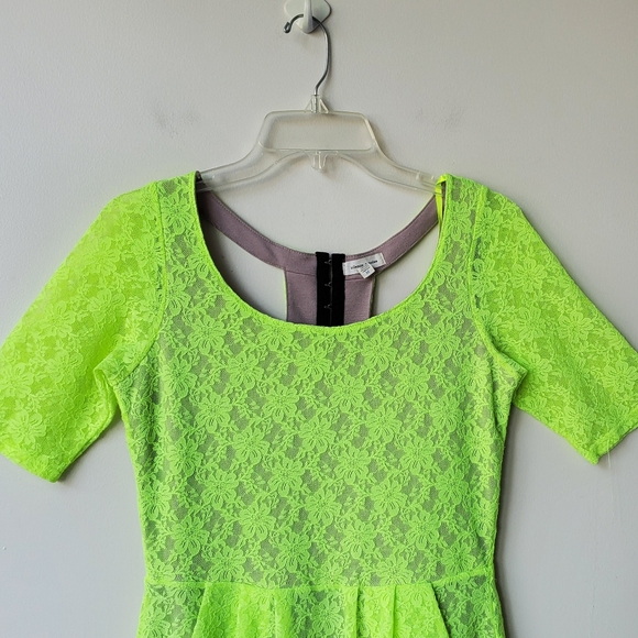 Silence + Noise Neon Lace Dress - Picture 2 of 15